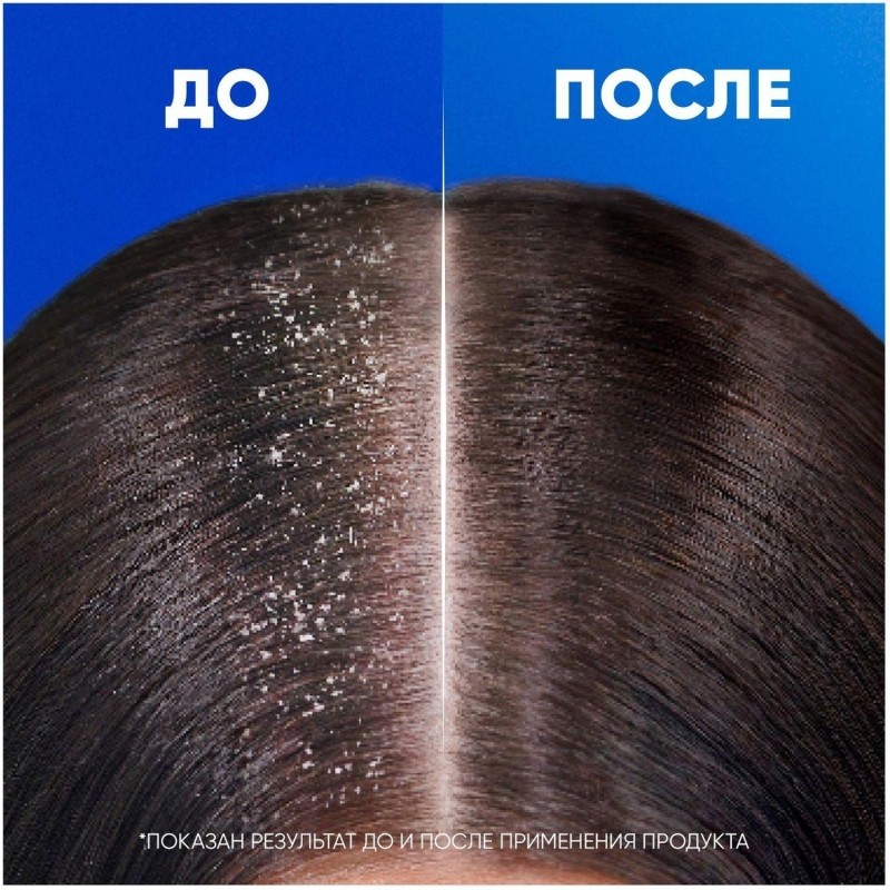 Шампунь HEAD &amp; SHOULDERS против перхоти Яблочная свежесть 400мл